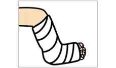 骨折した方にのイメージ